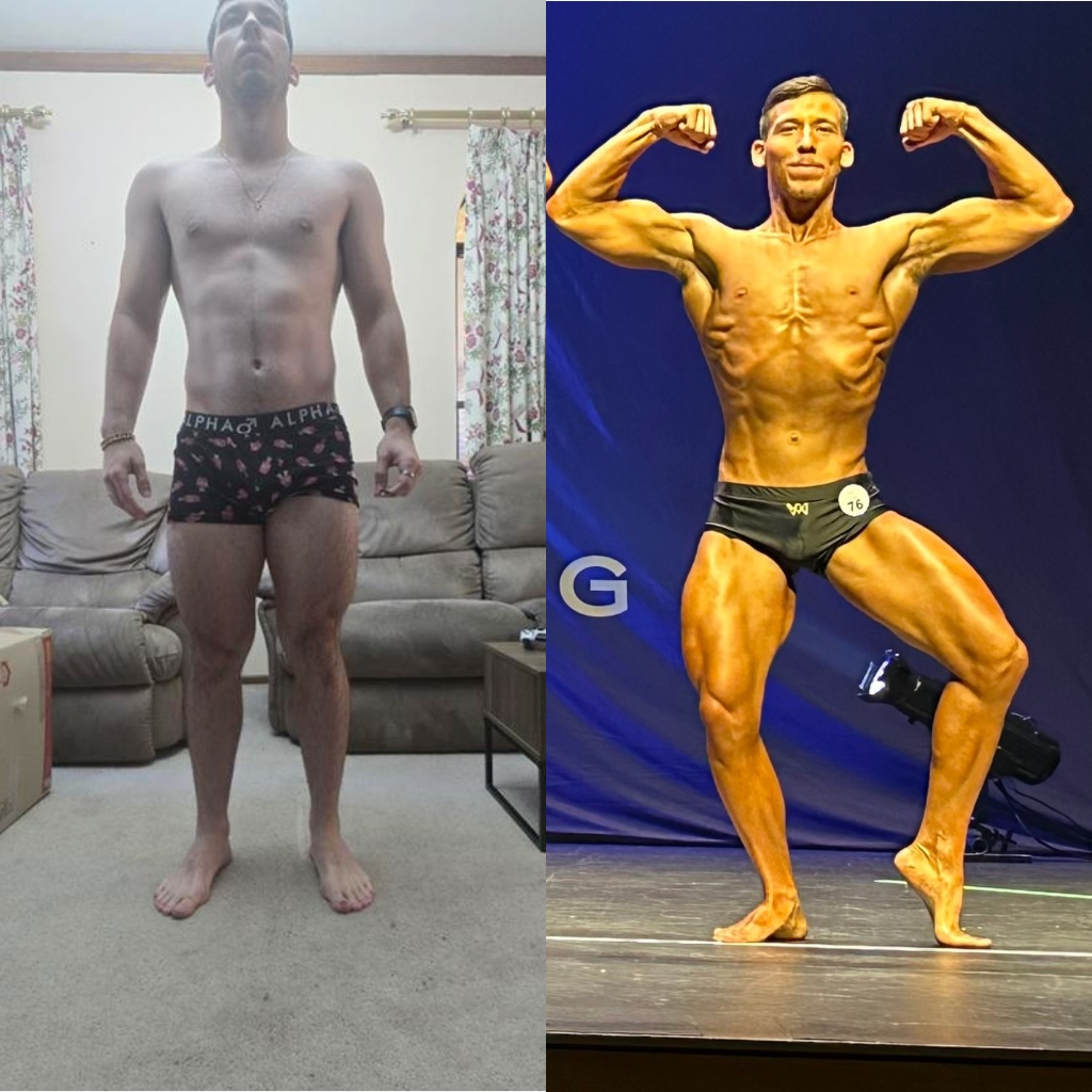 Zach C. before and after